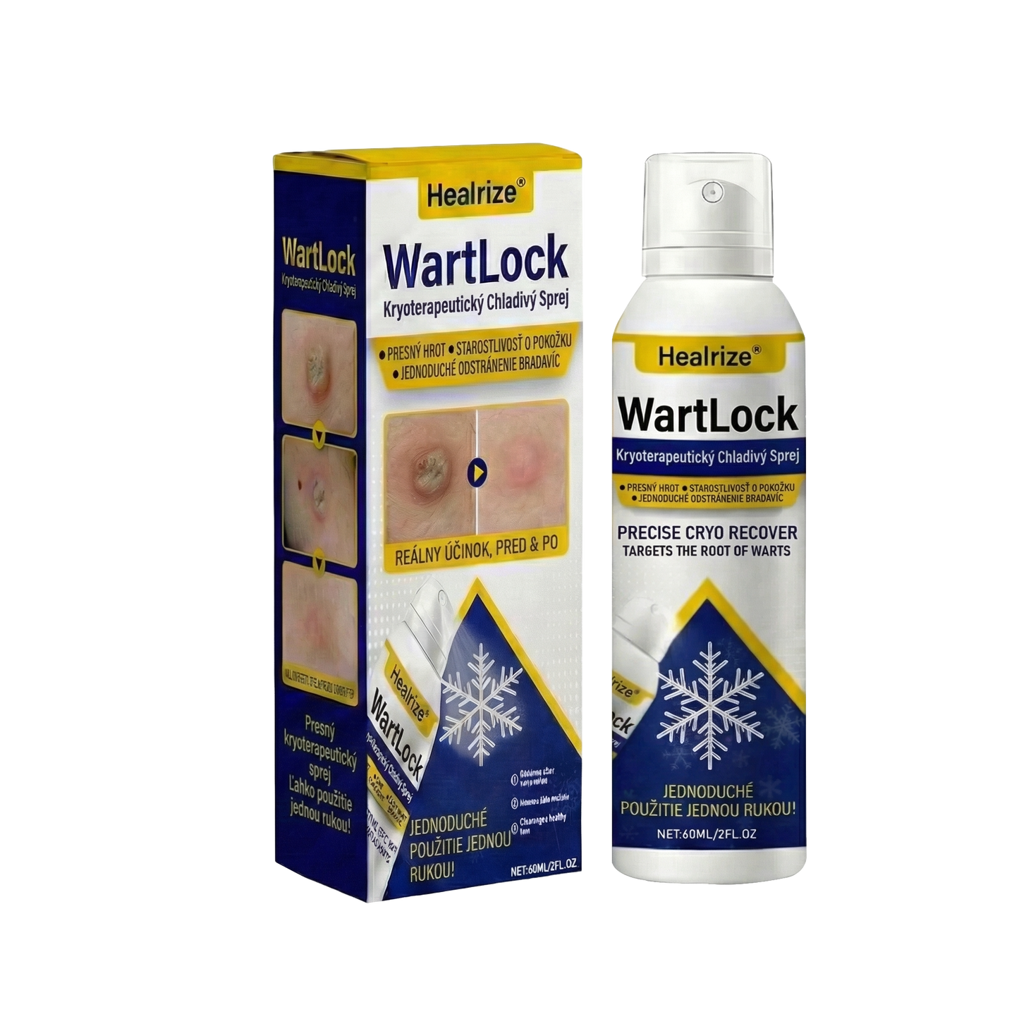 🏅𝑺𝒄𝒉𝒗á𝒍𝒆𝒏é 𝒂𝒈𝒆𝒏𝒕ú𝒓𝒐𝒖 𝑻𝑮𝑨 | Healrize® WartLock Kryoterapeutický Chladivý Sprej