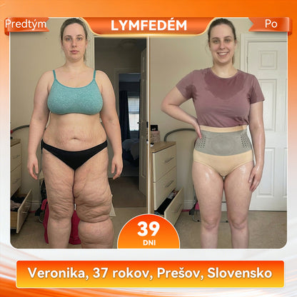 🍈🍈Oficiálna predajňa značky |✅ 𝐏𝐀𝐔𝐑𝐀𝐉𝐔® 𝟐𝟎𝟐𝟔 𝐌𝐎𝐑𝐈𝐍𝐆𝐀 & 𝐁𝐄𝐑𝐁𝐄𝐑Í𝐍 𝟒 𝐕 𝟏 𝐌𝐈𝐊𝐑𝐎Č𝐀𝐒𝐓𝐈𝐂𝐎𝐕É 𝐅𝐎𝐑𝐌𝐎𝐕𝐀𝐍𝐈𝐄 & 𝐒𝐎𝐑𝐓𝐊𝐘 𝐍𝐀 𝐒𝐏𝐀𝐋𝐎𝐕𝐀𝐍𝐈𝐄 𝐓𝐔𝐊𝐔