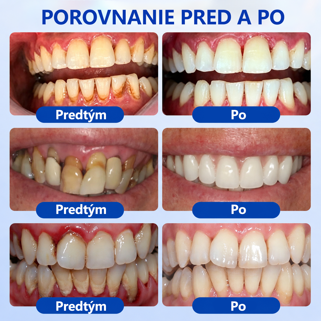 👩‍⚕️ 𝑮𝒍𝒊𝒎𝒎𝒆𝒓𝒍𝒚® 🦷 𝑮𝒖𝒎𝑹𝒆𝒗𝒊𝒗𝒆 – gél na obnovu parodontu 🎧