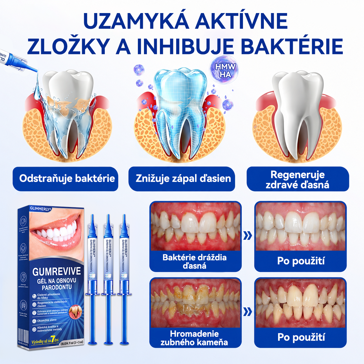 👩‍⚕️ 𝑮𝒍𝒊𝒎𝒎𝒆𝒓𝒍𝒚® 🦷 𝑮𝒖𝒎𝑹𝒆𝒗𝒊𝒗𝒆 – gél na obnovu parodontu 🎧