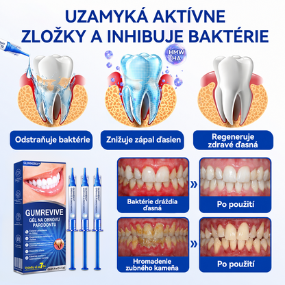 👩‍⚕️ 𝑮𝒍𝒊𝒎𝒎𝒆𝒓𝒍𝒚® 🦷 𝑮𝒖𝒎𝑹𝒆𝒗𝒊𝒗𝒆 – gél na obnovu parodontu 🎧
