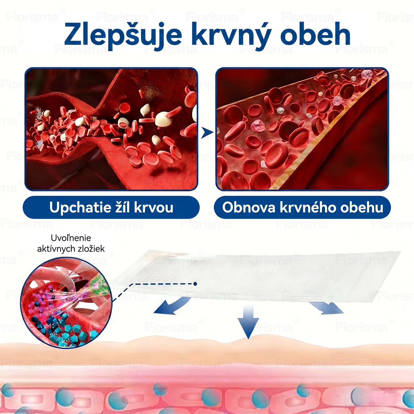 Jedna náplasť denne. Viditeľná úľava od žíl už za 7 dní🍃 𝑭𝑳𝑶𝑹𝑰𝑺𝑴𝑨® 𝐃𝐈𝐎𝐒𝐌𝐈𝐍 & 𝐇𝐄𝐒𝐏𝐄𝐑𝐈𝐃𝐈𝐍 𝐊𝐥𝐢𝐧𝐢𝐜𝐤ý-𝐒𝐭𝐮𝐩𝐞ň 𝐅𝐨𝐫𝐦𝐮𝐥𝐚 𝐬 𝐌𝐢𝐤𝐫𝐨𝐧𝐞𝐞𝐝𝐥𝐞 𝐬 𝐌𝐢𝐤𝐫𝐨𝐧𝐞𝐞𝐝𝐥𝐞 𝐍á𝐩𝐥𝐚𝐬𝐭𝐨𝐮 Pokročilá bylinná zmes cielene pôsobí na metličkové žilky a uvoľňuje ťažké a unavené nohy🎊