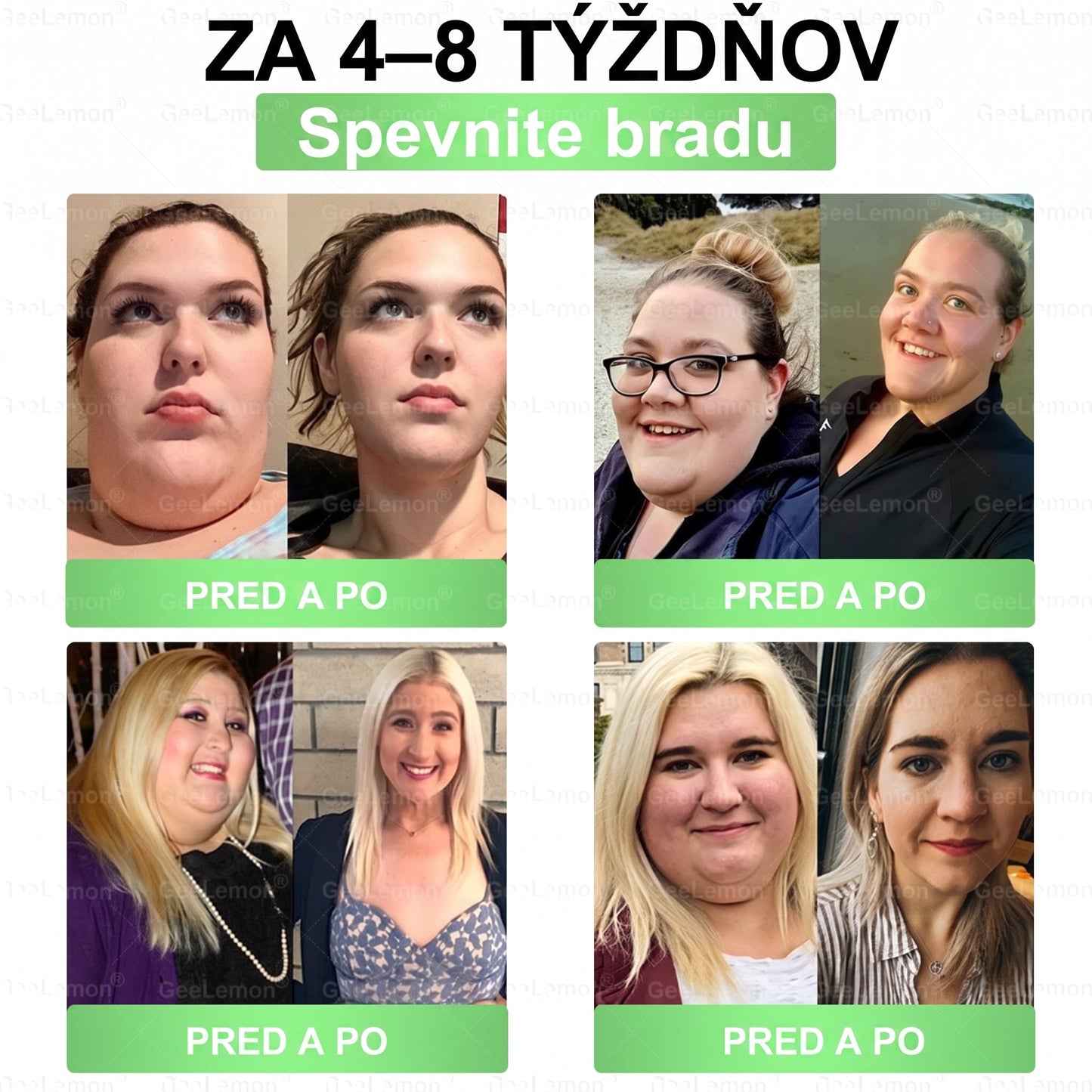 Oficiálne certifikované 🔥 Tisíce spokojných používateľov na Slovensku💗🥰𝐆𝐞𝑒𝐿𝑒𝐦𝐨𝐧® 𝐆𝐥𝐮𝐦𝐚𝐬𝐞𝐭𝐢𝐝𝐞  8 IN 1" TENKY A ZDRAVY MIKROIHLICKOVY PLASTER ((Iba raz denne, viditeľné zmeny do 7 dní))  ✅