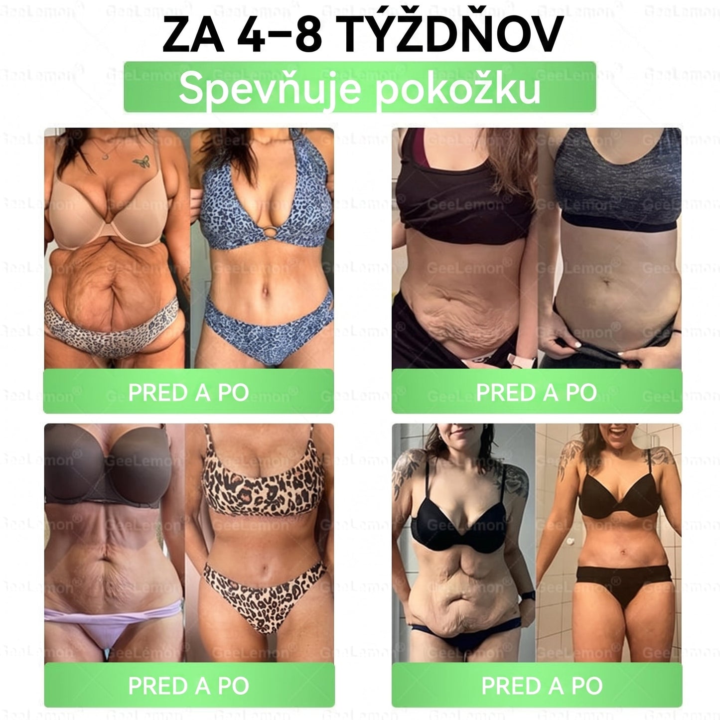 Oficiálne certifikované 🔥 Tisíce spokojných používateľov na Slovensku💗🥰𝐆𝐞𝑒𝐿𝑒𝐦𝐨𝐧® 𝐆𝐥𝐮𝐦𝐚𝐬𝐞𝐭𝐢𝐝𝐞  8 IN 1" TENKY A ZDRAVY MIKROIHLICKOVY PLASTER ((Iba raz denne, viditeľné zmeny do 7 dní))  ✅