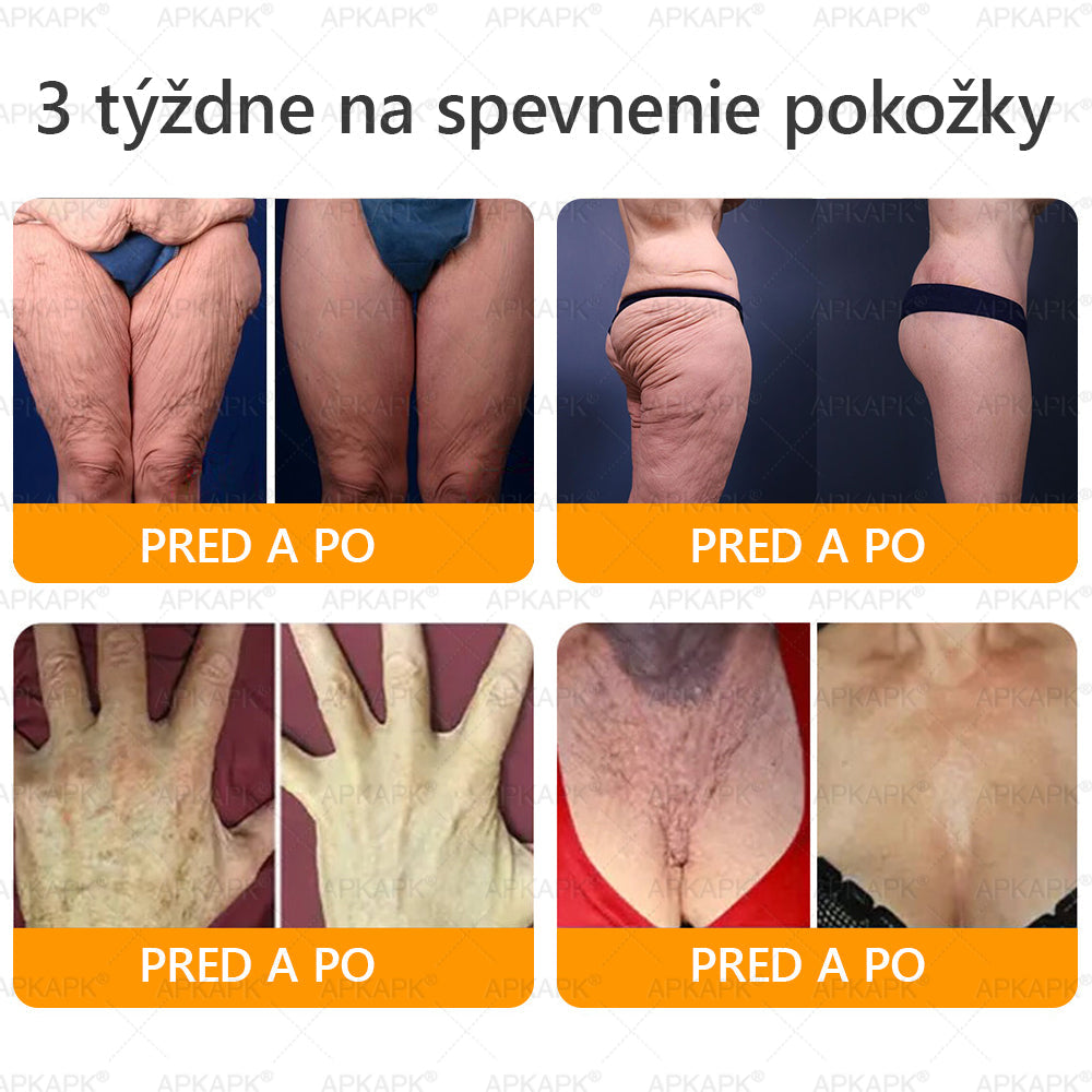 ✨APKAPK® Včelí jed regeneračný krém na pokožku 🔥 Vyvinuté na Slovensku, vyrobené a dodávané zo Slovenska🫏