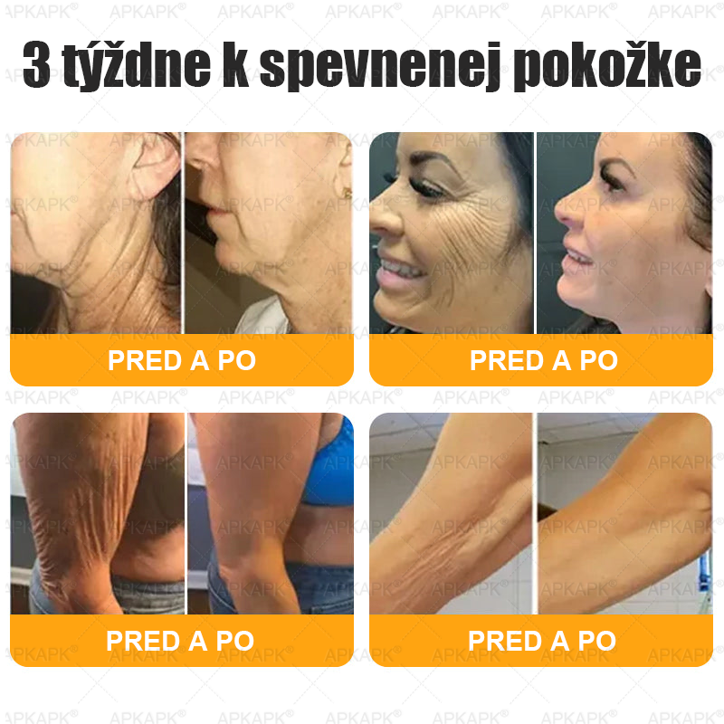 ✨APKAPK® Včelí jed regeneračný krém na pokožku 🔥 Vyvinuté na Slovensku, vyrobené a dodávané zo Slovenska🫏