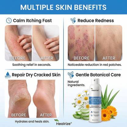Healrize® Magnesium Botanical Spray🔥 – Advanced Skin Recovery for Psoriasis & Eczema | Rapid Soothing, Steroid-Free