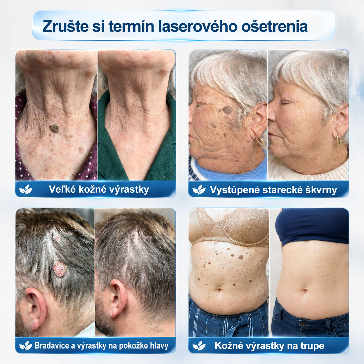 ✅✨𝐎𝐟𝐢𝐜𝐢á𝐥𝐧𝐚 𝐩𝐫𝐞𝐝𝐚𝐣ň𝐚 𝐳𝐧𝐚č𝐤𝐲 𝐏𝐢𝐜𝐝𝐨® 𝟕-𝐝ň𝐨𝐯ý 𝐨𝐝𝐬𝐭𝐫𝐚ň𝐨𝐯𝐚č   𝐤𝐨ž𝐧ý𝐜𝐡 𝐯ý𝐫𝐚𝐬𝐭𝐤𝐨𝐯 𝐚 š𝐤𝐯𝐫𝐧(𝐑𝐨𝐥𝐥𝐞𝐫𝐛𝐚𝐥𝐥 𝐛𝐞𝐳 𝐛𝐨𝐥𝐞𝐬𝐭𝐢, 𝐛𝐞𝐳 𝐣𝐚𝐳𝐢𝐞𝐯)