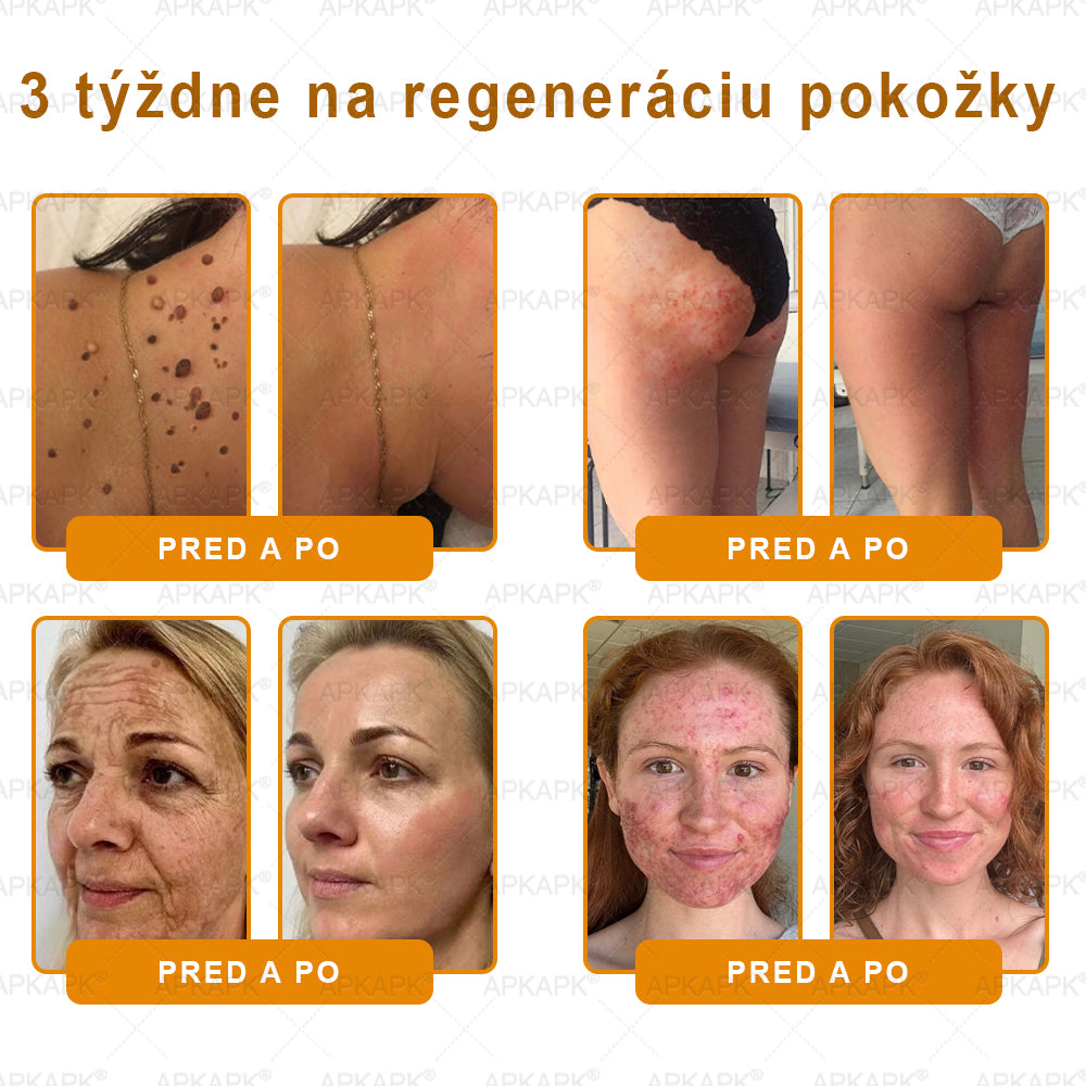 ✨APKAPK® Včelí jed regeneračný krém na pokožku 🔥 Vyvinuté na Slovensku, vyrobené a dodávané zo Slovenska🫏