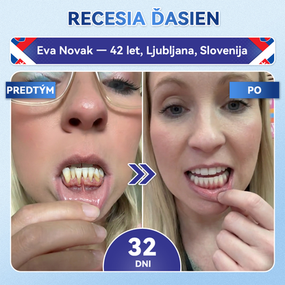 🦷𝐆𝐥𝐢𝐦𝐦𝐞𝐫𝐥𝐲® Tideglusib zuby a dasna Opravná náplasť s mikroihlami  | Pokročilé zubné pásiky s aktiváciou kmeňových buniek (obnova skloviny a dentínu • posilnenie ďasien • odstránenie zubného kameňa a zápachu • zastavenie citlivosti zubov)) 3.0