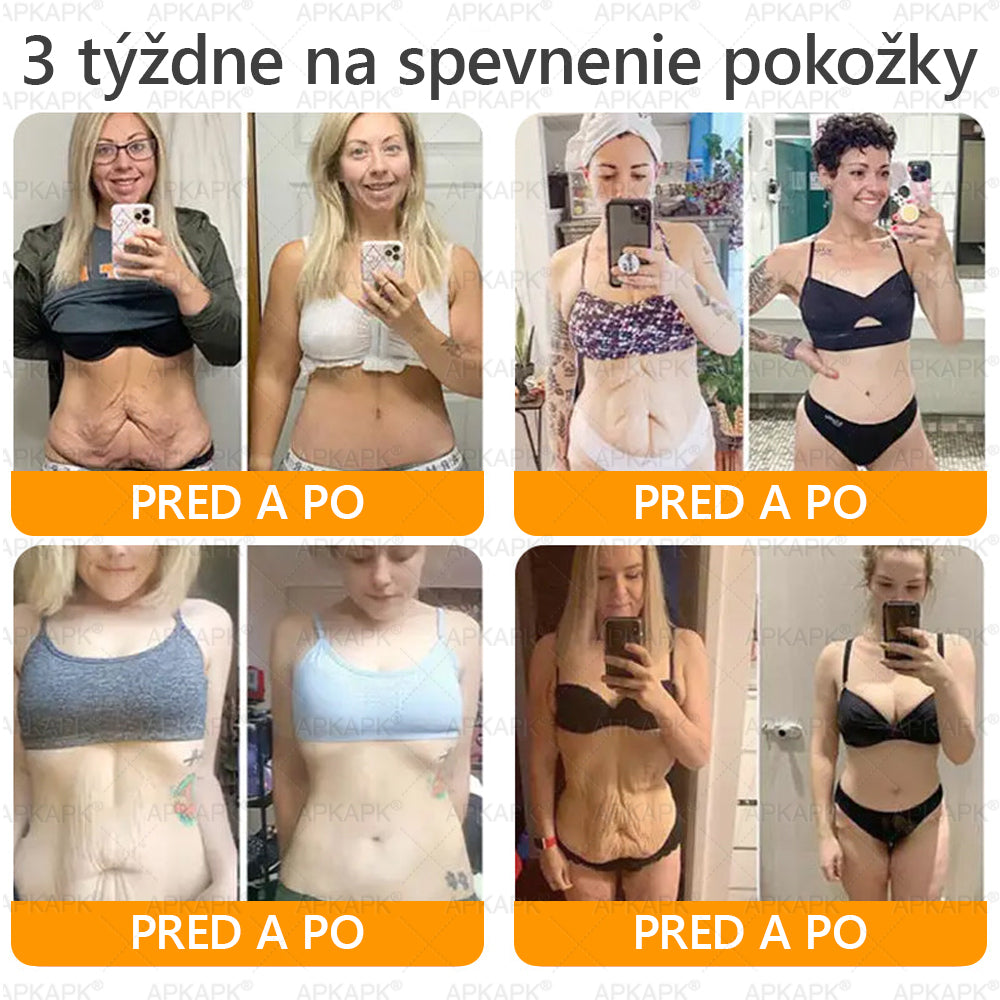 ✨APKAPK® Včelí jed regeneračný krém na pokožku 🔥 Vyvinuté na Slovensku, vyrobené a dodávané zo Slovenska🫏