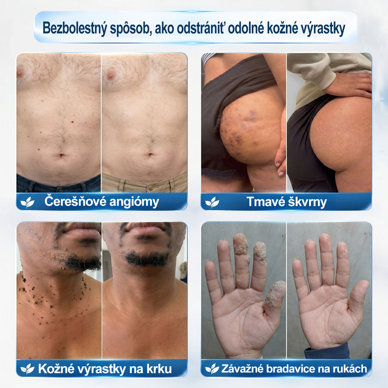 ✅✨𝐎𝐟𝐢𝐜𝐢á𝐥𝐧𝐚 𝐩𝐫𝐞𝐝𝐚𝐣ň𝐚 𝐳𝐧𝐚č𝐤𝐲 𝐏𝐢𝐜𝐝𝐨® 𝟕-𝐝ň𝐨𝐯ý 𝐨𝐝𝐬𝐭𝐫𝐚ň𝐨𝐯𝐚č   𝐤𝐨ž𝐧ý𝐜𝐡 𝐯ý𝐫𝐚𝐬𝐭𝐤𝐨𝐯 𝐚 š𝐤𝐯𝐫𝐧(𝐑𝐨𝐥𝐥𝐞𝐫𝐛𝐚𝐥𝐥 𝐛𝐞𝐳 𝐛𝐨𝐥𝐞𝐬𝐭𝐢, 𝐛𝐞𝐳 𝐣𝐚𝐳𝐢𝐞𝐯)