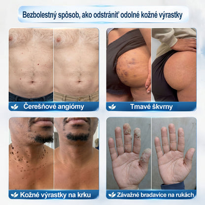 ✅✨𝐎𝐟𝐢𝐜𝐢á𝐥𝐧𝐚 𝐩𝐫𝐞𝐝𝐚𝐣ň𝐚 𝐳𝐧𝐚č𝐤𝐲 𝐏𝐢𝐜𝐝𝐨® 𝟕-𝐝ň𝐨𝐯ý 𝐨𝐝𝐬𝐭𝐫𝐚ň𝐨𝐯𝐚č   𝐤𝐨ž𝐧ý𝐜𝐡 𝐯ý𝐫𝐚𝐬𝐭𝐤𝐨𝐯 𝐚 š𝐤𝐯𝐫𝐧(𝐑𝐨𝐥𝐥𝐞𝐫𝐛𝐚𝐥𝐥 𝐛𝐞𝐳 𝐛𝐨𝐥𝐞𝐬𝐭𝐢, 𝐛𝐞𝐳 𝐣𝐚𝐳𝐢𝐞𝐯)