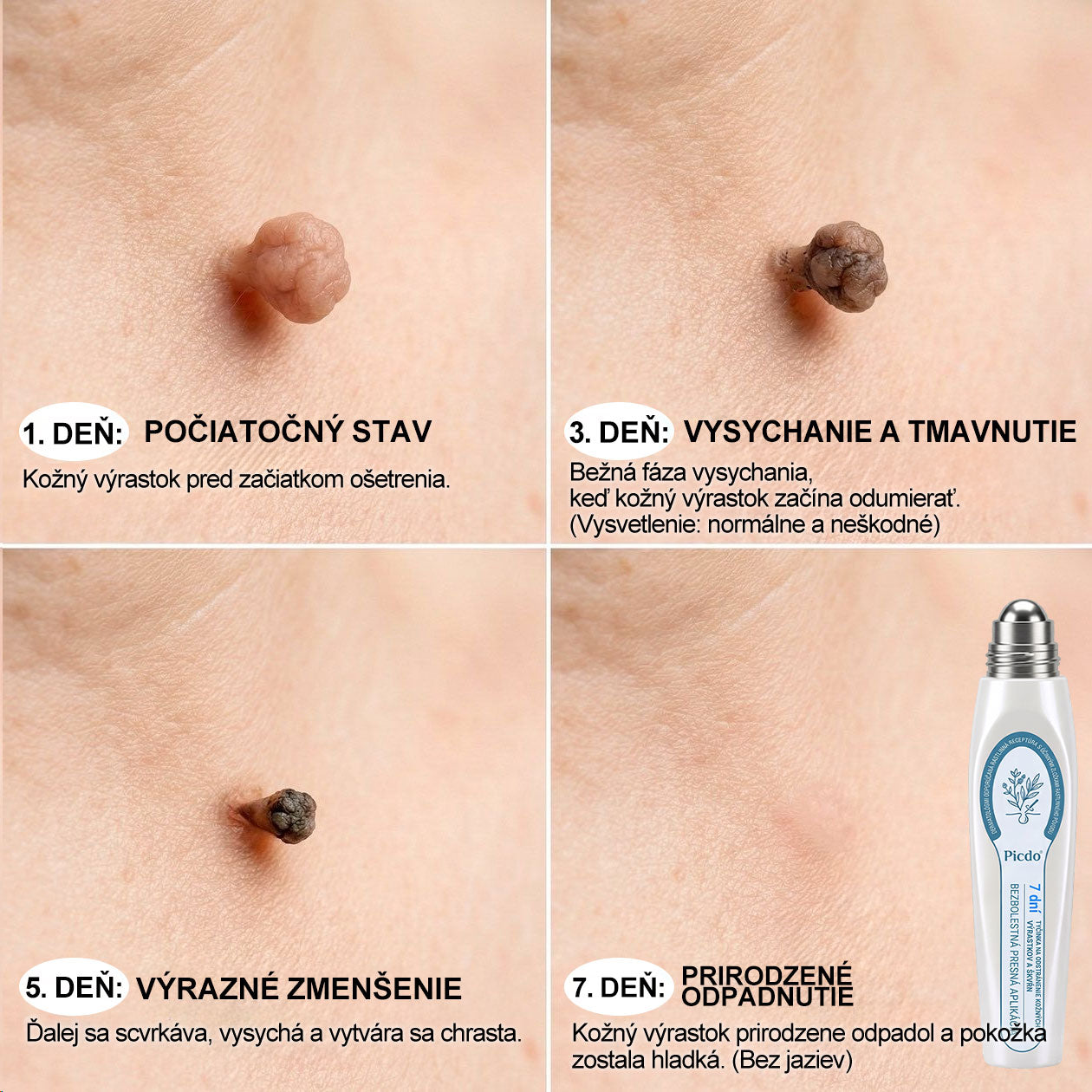 ✅✨𝐎𝐟𝐢𝐜𝐢á𝐥𝐧𝐚 𝐩𝐫𝐞𝐝𝐚𝐣ň𝐚 𝐳𝐧𝐚č𝐤𝐲 𝐏𝐢𝐜𝐝𝐨® 𝟕-𝐝ň𝐨𝐯ý 𝐨𝐝𝐬𝐭𝐫𝐚ň𝐨𝐯𝐚č   𝐤𝐨ž𝐧ý𝐜𝐡 𝐯ý𝐫𝐚𝐬𝐭𝐤𝐨𝐯 𝐚 š𝐤𝐯𝐫𝐧(𝐑𝐨𝐥𝐥𝐞𝐫𝐛𝐚𝐥𝐥 𝐛𝐞𝐳 𝐛𝐨𝐥𝐞𝐬𝐭𝐢, 𝐛𝐞𝐳 𝐣𝐚𝐳𝐢𝐞𝐯)