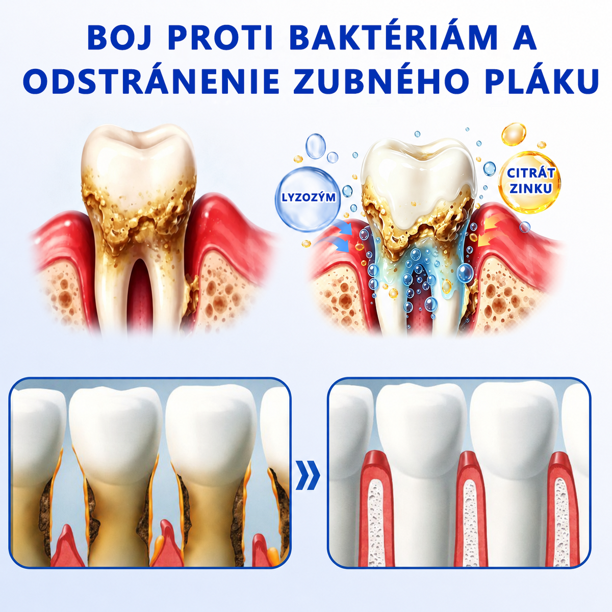 👩‍⚕️ 𝑮𝒍𝒊𝒎𝒎𝒆𝒓𝒍𝒚® 🦷 𝑮𝒖𝒎𝑹𝒆𝒗𝒊𝒗𝒆 – gél na obnovu parodontu 🎧