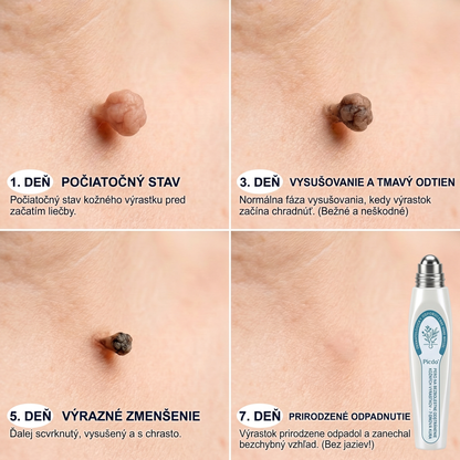 𝐏i𝐜𝐝o® 𝟕-𝐝ñ𝐨𝐯𝐲 𝐨𝐝𝐬𝐭𝐫𝐚ñ𝐨𝐯𝐚č 𝐤𝐨ž𝐧ý𝐜𝐡 𝐯ý𝐫𝐚𝐬𝐭𝐤𝐨𝐯 𝐚 š𝐤𝐯𝐫𝐧(Žiadna bolesť, nula rollerballov)💪