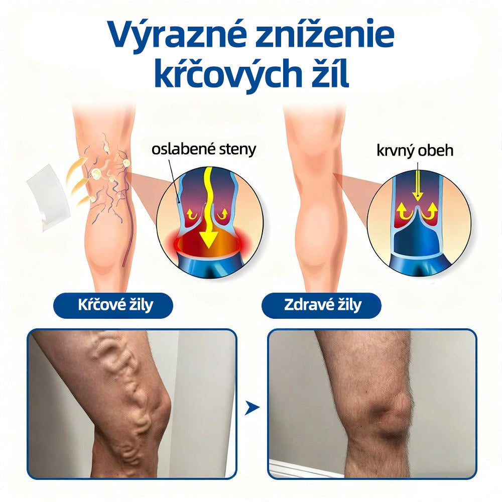 Healrize® VeinTarget mikrojihlová náplasť 🚀 Okamžitá úľava, dlhodobé výsledky 🚀
