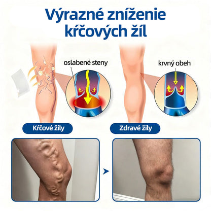 Healrize® VeinTarget mikrojihlová náplasť 🚀 Okamžitá úľava, dlhodobé výsledky 🚀