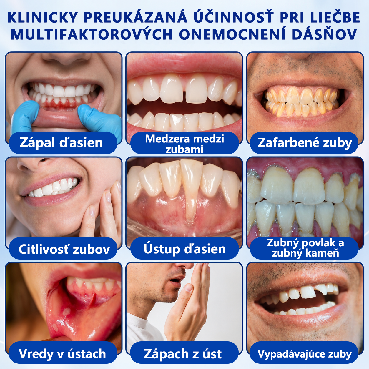 👩‍⚕️ 𝑮𝒍𝒊𝒎𝒎𝒆𝒓𝒍𝒚® 🦷 𝑮𝒖𝒎𝑹𝒆𝒗𝒊𝒗𝒆 – gél na obnovu parodontu 🎧