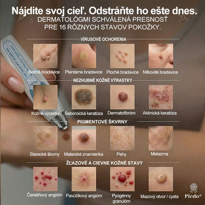 ✅✨𝐎𝐟𝐢𝐜𝐢á𝐥𝐧𝐚 𝐩𝐫𝐞𝐝𝐚𝐣ň𝐚 𝐳𝐧𝐚č𝐤𝐲 𝐏𝐢𝐜𝐝𝐨® 𝟕-𝐝ň𝐨𝐯ý 𝐨𝐝𝐬𝐭𝐫𝐚ň𝐨𝐯𝐚č   𝐤𝐨ž𝐧ý𝐜𝐡 𝐯ý𝐫𝐚𝐬𝐭𝐤𝐨𝐯 𝐚 š𝐤𝐯𝐫𝐧(𝐑𝐨𝐥𝐥𝐞𝐫𝐛𝐚𝐥𝐥 𝐛𝐞𝐳 𝐛𝐨𝐥𝐞𝐬𝐭𝐢, 𝐛𝐞𝐳 𝐣𝐚𝐳𝐢𝐞𝐯)