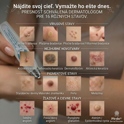 𝐏i𝐜𝐝o® 𝟕-𝐝ñ𝐨𝐯𝐲 𝐨𝐝𝐬𝐭𝐫𝐚ñ𝐨𝐯𝐚č 𝐤𝐨ž𝐧ý𝐜𝐡 𝐯ý𝐫𝐚𝐬𝐭𝐤𝐨𝐯 𝐚 š𝐤𝐯𝐫𝐧(Žiadna bolesť, nula rollerballov)💪