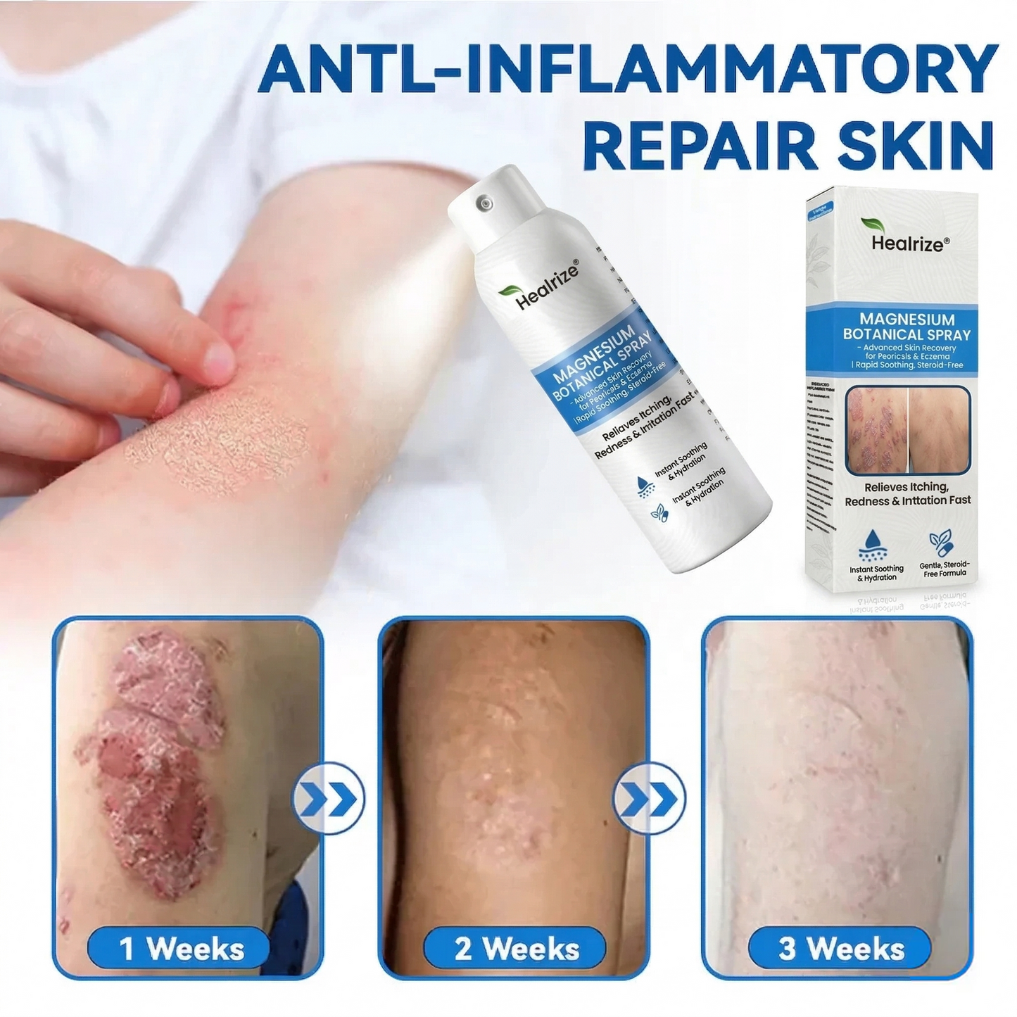 Healrize® Magnesium Botanical Spray🔥 – Advanced Skin Recovery for Psoriasis & Eczema | Rapid Soothing, Steroid-Free