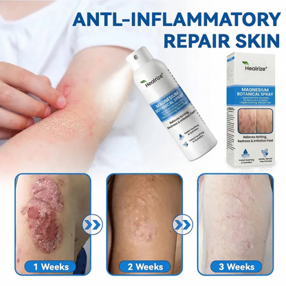 Healrize® Magnesium Botanical Spray🔥 – Advanced Skin Recovery for Psoriasis & Eczema | Rapid Soothing, Steroid-Free