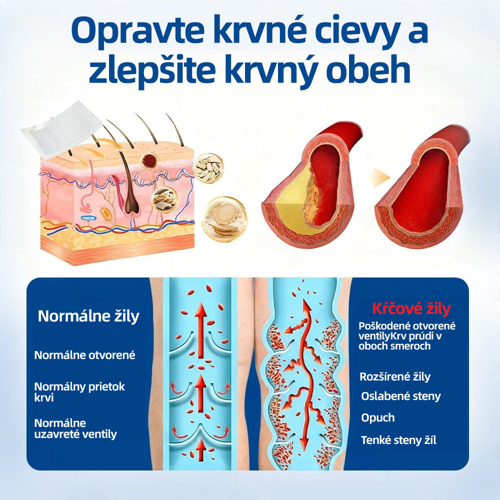 Healrize® VeinTarget mikrojihlová náplasť 🚀 Okamžitá úľava, dlhodobé výsledky 🚀