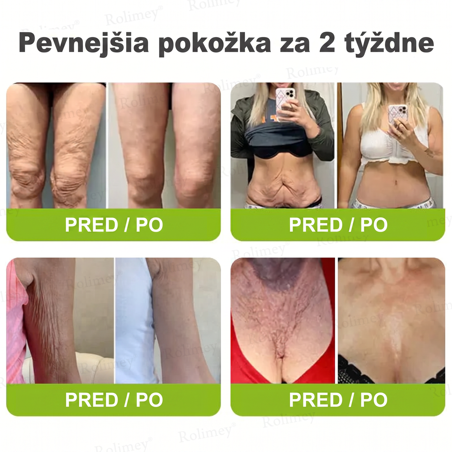 🌸Rolimey®  Botox & Vita-A Retinol Retinol Shot Krém proti vraskam a na spevnenie pleti ⏰Posledný deň! 70% zľava💡