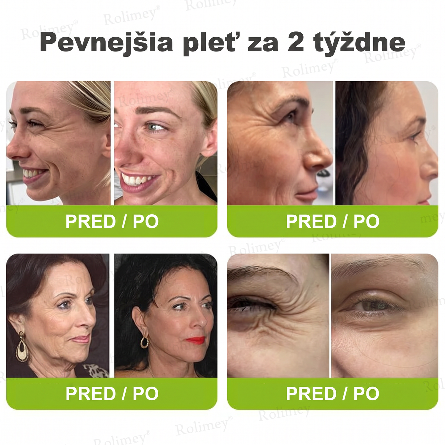 🌸Rolimey®  Botox & Vita-A Retinol Retinol Shot Krém proti vraskam a na spevnenie pleti ⏰Posledný deň! 70% zľava💡