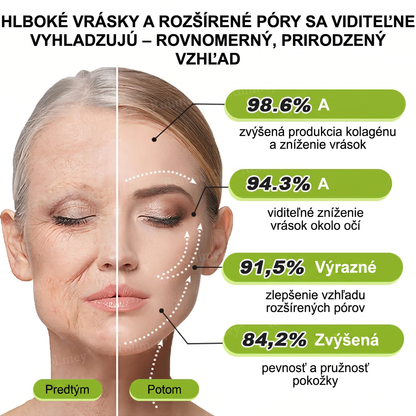 🌸Rolimey®  Botox & Vita-A Retinol Retinol Shot Krém proti vraskam a na spevnenie pleti ⏰Posledný deň! 70% zľava💡