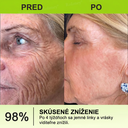 🌸Rolimey®  Botox & Vita-A Retinol Retinol Shot Krém proti vraskam a na spevnenie pleti ⏰Posledný deň! 70% zľava💡