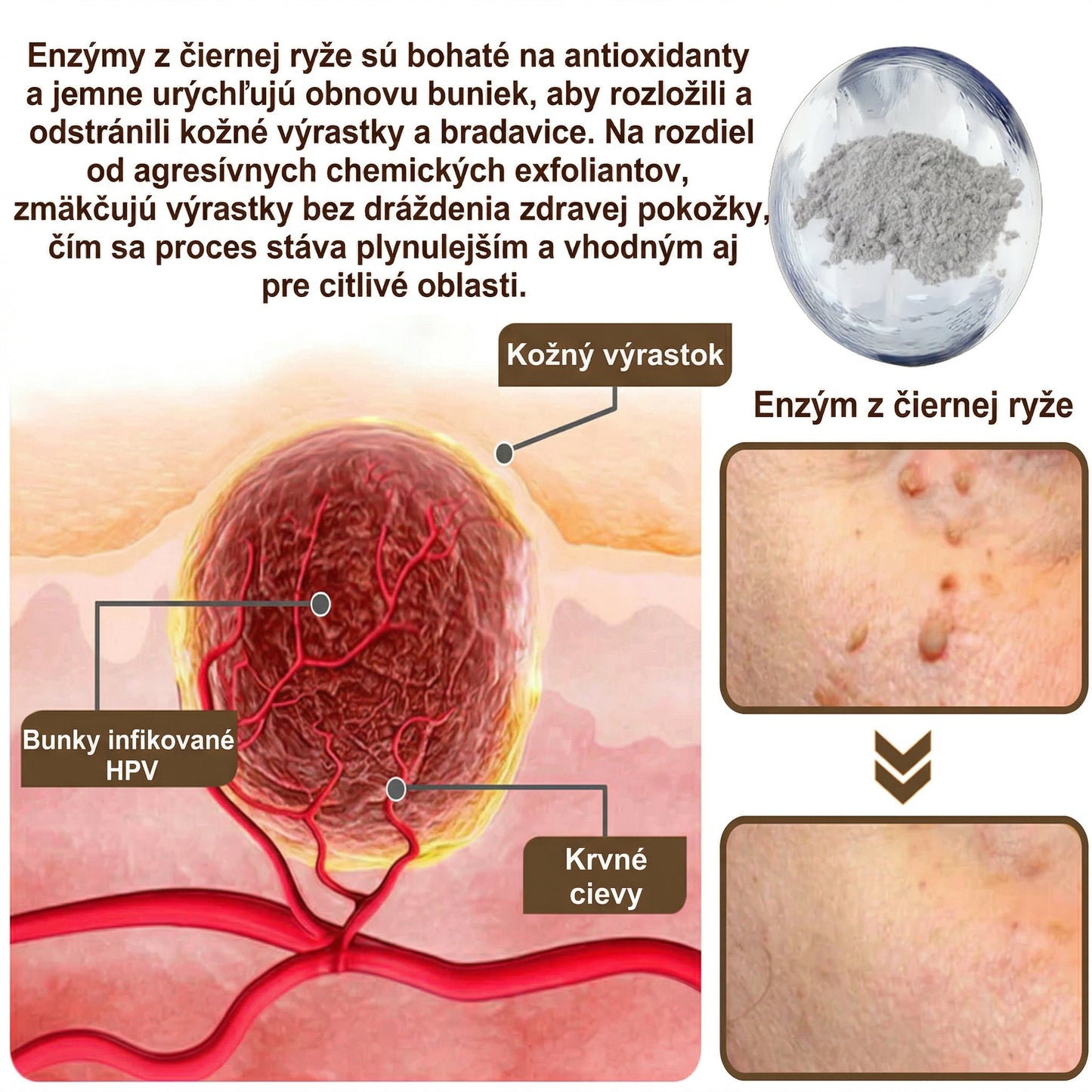 FIVFIVGO® Upokojujúci regeneračný krém s čiernou a bielou ryžou👨‍⚕️ Schválené ŠÚKL(Odstraňovanie bradavíc a kožných výrastkov, senilnej purpury, čerešňových angiómov, rakoviny kože a seboroickej keratózy).)⏰