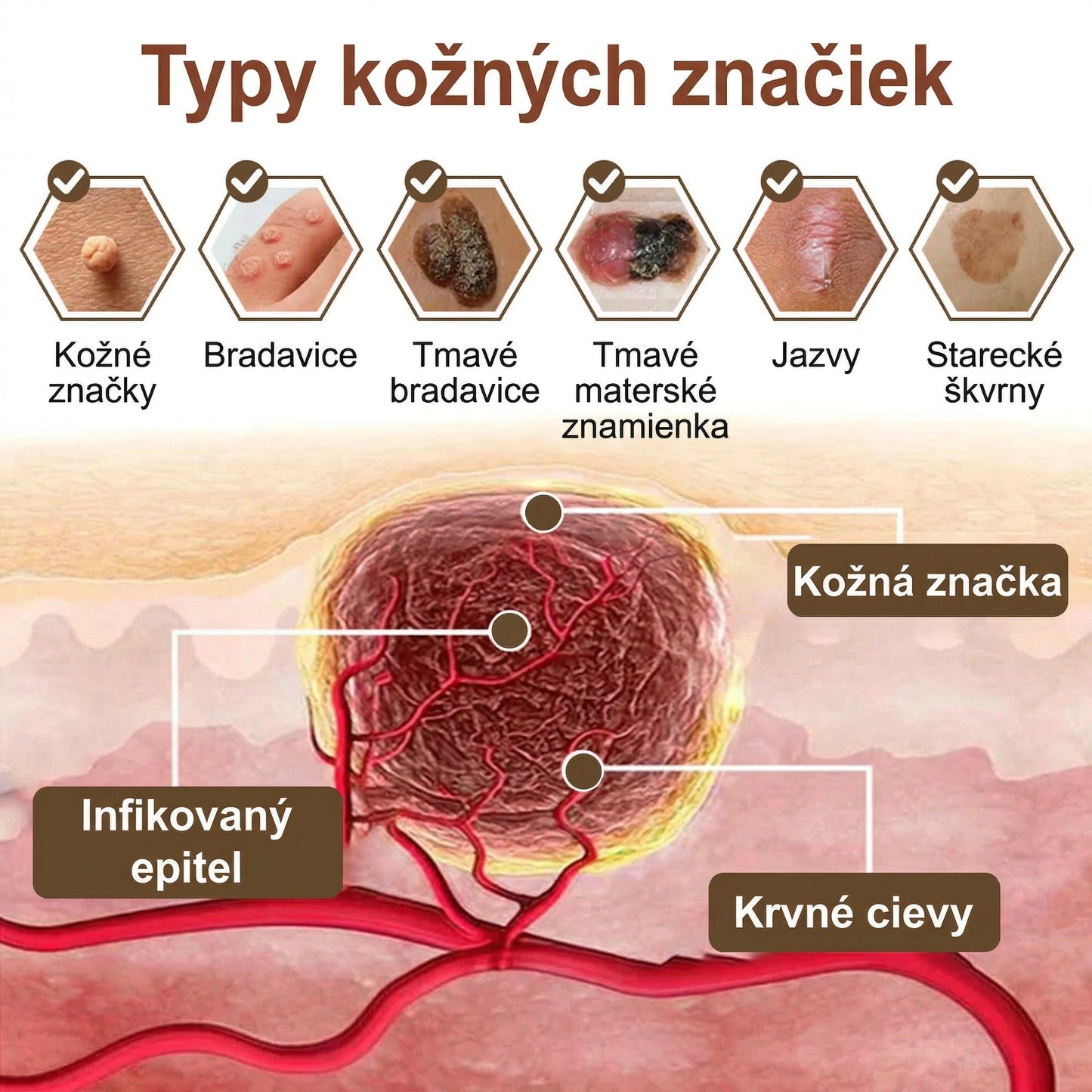 FIVFIVGO® Upokojujúci regeneračný krém s čiernou a bielou ryžou👨‍⚕️ Schválené ŠÚKL(Odstraňovanie bradavíc a kožných výrastkov, senilnej purpury, čerešňových angiómov, rakoviny kože a seboroickej keratózy).)⏰
