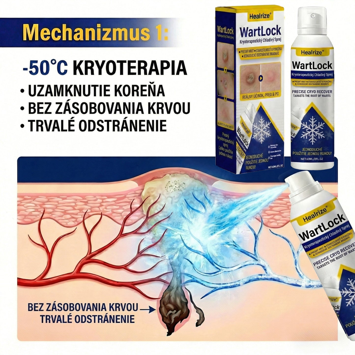𝑺𝒄𝒉𝒗á𝒍𝒆𝒏é 𝒂𝒈𝒆𝒏𝒕ú𝒓𝒐𝒖 𝑻𝑮𝑨 | Healrize® WartLock Kryoterapeutický Chladivý Sprej🔴
