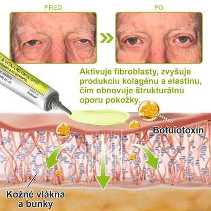 🌸Rolimey®  Botox & Vita-A Retinol Retinol Shot Krém proti vraskam a na spevnenie pleti ⏰Posledný deň! 70% zľava💡