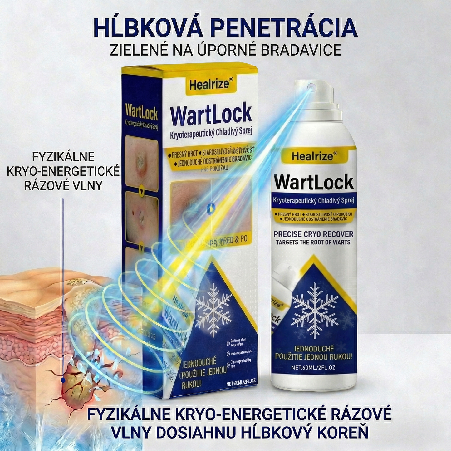 𝑺𝒄𝒉𝒗á𝒍𝒆𝒏é 𝒂𝒈𝒆𝒏𝒕ú𝒓𝒐𝒖 𝑻𝑮𝑨 | Healrize® WartLock Kryoterapeutický Chladivý Sprej🔴