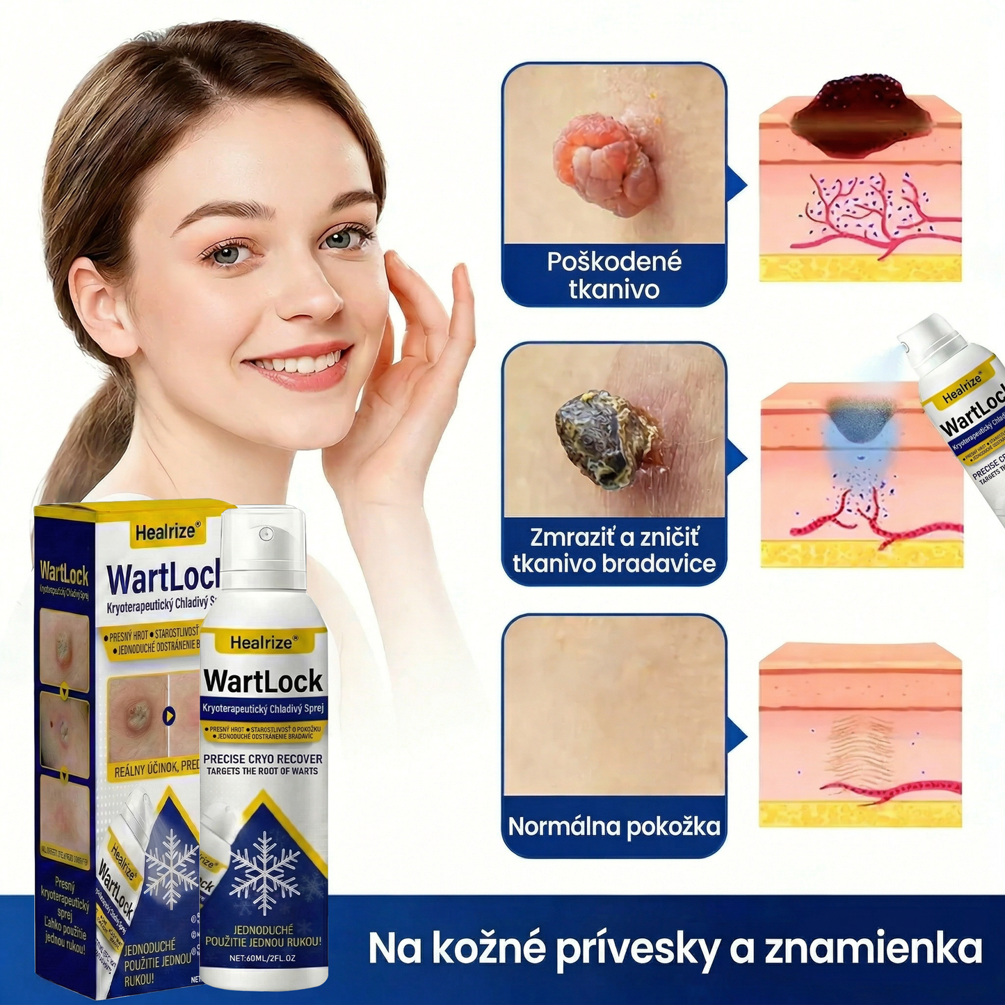 𝑺𝒄𝒉𝒗á𝒍𝒆𝒏é 𝒂𝒈𝒆𝒏𝒕ú𝒓𝒐𝒖 𝑻𝑮𝑨 | Healrize® WartLock Kryoterapeutický Chladivý Sprej🔴