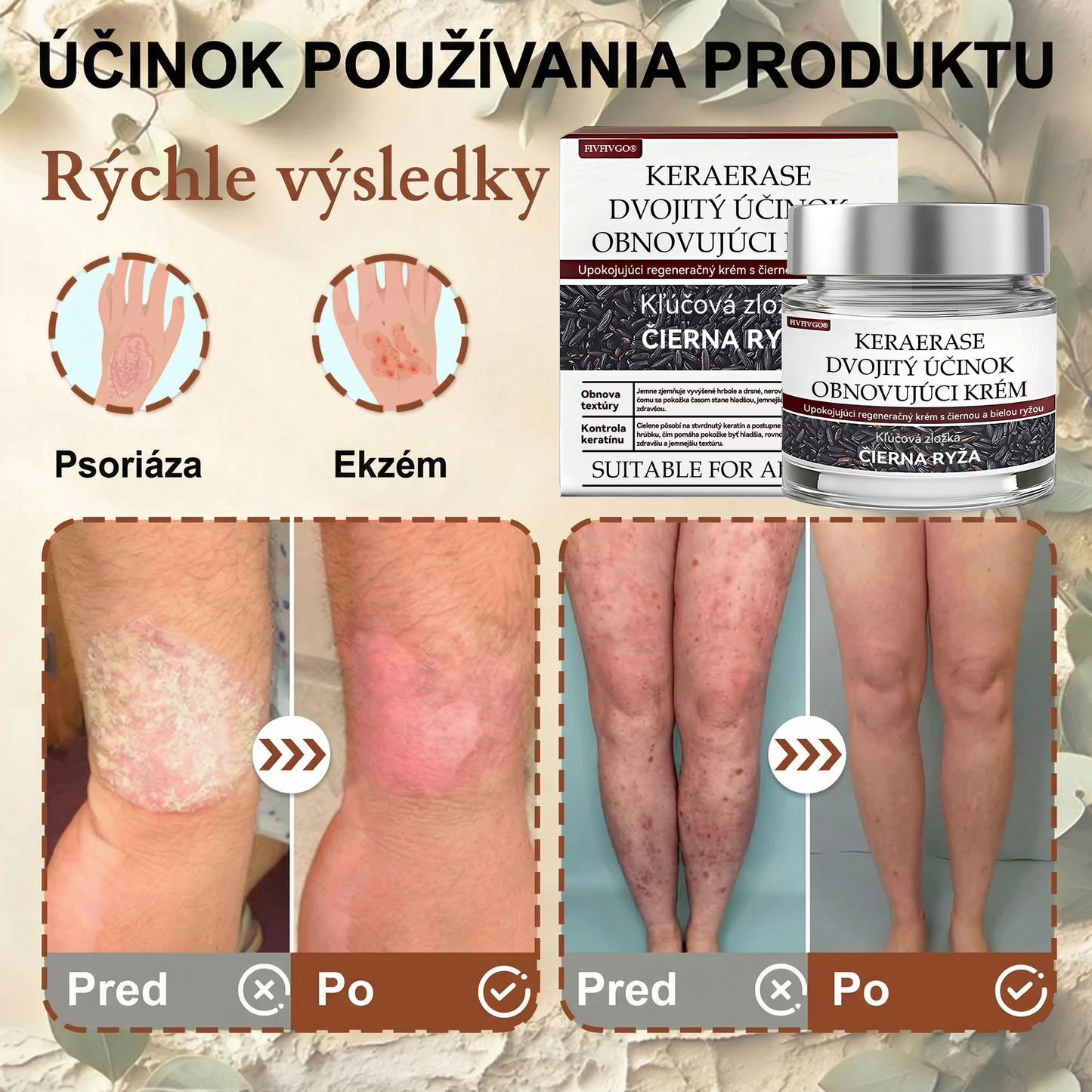 FIVFIVGO® Upokojujúci regeneračný krém s čiernou a bielou ryžou👨‍⚕️ Schválené ŠÚKL(Odstraňovanie bradavíc a kožných výrastkov, senilnej purpury, čerešňových angiómov, rakoviny kože a seboroickej keratózy).)⏰