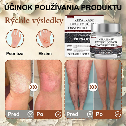 FIVFIVGO® Upokojujúci regeneračný krém s čiernou a bielou ryžou👨‍⚕️ Schválené ŠÚKL(Odstraňovanie bradavíc a kožných výrastkov, senilnej purpury, čerešňových angiómov, rakoviny kože a seboroickej keratózy).)⏰
